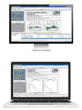 Iris-Power-Partial-Discharge-Monitoring-PDTRACII-2-586x400